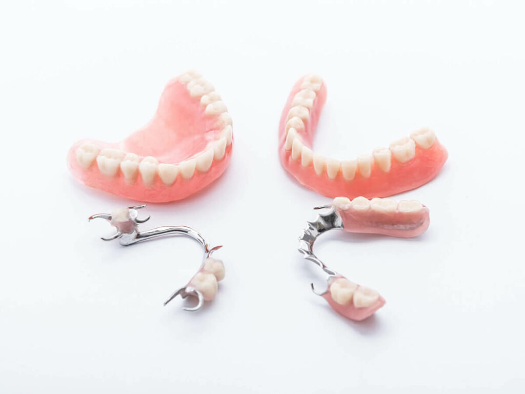 Full and partial denture examples